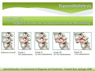 Spinal Disorders. Fundamental of Diagnosis and Treatment. Norbert Boss. Springer 2008
 