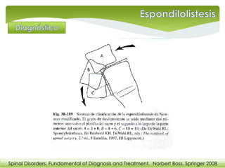 Spinal Disorders. Fundamental of Diagnosis and Treatment. Norbert Boss. Springer 2008
 