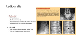 Radiografia
 