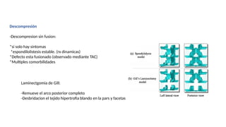 Descompresión
-Descompresion sin fusion:
*si solo hay sintomas
*espondilolistesis estable. (rx dinamicas)
*Defecto esta fusionado (observado mediante TAC)
*Multiples comorbilidades
Laminectgomia de Gill:
-Remueve el arco posterior completo
-Desbridacion el tejido hipertrofia blando en la pars y facetas
 