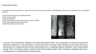 Fusión Intersomática
Se recomienda fusión intersomático en caso de fracaso en el tratamiento conservador en espondilolistesis ístmica. En caso de dolor severo y discapacidad
funcional.
1.-Instrumentacion lumbar con tornillo pediculares.
2.-Fijacion interna rígida
*Fusion posterolateral
*Fusión intersomático lumbar transfor aminal o posterior (T/PLIF).
*Fusión intersonamatica lumbar lateral (LLIF)
*Fusión intersomático lumbar anterior.
La técnica más comúnmente utilizada es la fusión posterolateral (PLF), que comprende un injerto de hueso de los
elementos posteriores. Como alternativa, el injerto de hueso se puede realizar después de la escisión del disco y
decorticacion de la placa terminal (fusión intersomática) por un abordaje posterior (posterior fusión intersomática
lumbar, PLIF) o el enfoque anterior (anterior fusión intersomática lumbar, ALIF). El llamado combinado de fusión o
de 360 grados es la combinación de ambas técnicas.
 