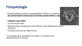 Fisiopatología
• Entidad patológica primaria en Espondilolistesis ístmica es un defecto en la
pars interarticularis.(intersección de la lamina articular inferior y superior)
• 3 Defectos según Wiltse
• -A: Fractura por estrés.
• -BCuerpo Integro alargado pero itacto debido a ciclos repetidos de trauma y
reparacion
• -C:Fractura d ela pars por algún trauma
*Las Etiologias de la espondillisis son muchas y se relación a una
hiperextensión de la columna
 