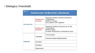 • Etiologica ( Marchetti)
 