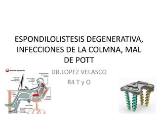 ESPONDILOLISTESIS DEGENERATIVA,
INFECCIONES DE LA COLMNA, MAL
DE POTT
DR.LOPEZ VELASCO
R4 T y O

 