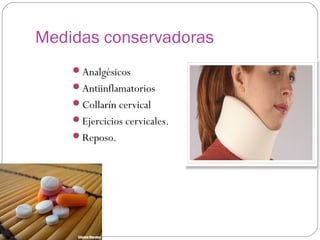 Medidas conservadoras
Analgésicos
Antiinflamatorios
Collarín cervical
Ejercicios cervicales.
Reposo.

 