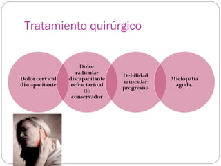 Tratamiento quirúrgico

 