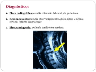 1. Placa radiográfica: estudia el tamaño del canal y la parte ósea.
2. Resonancia Magnética: observa ligamentos, disco, raíces y médula
cervical. (prueba diagnóstica)
3. Electromiografía: evalúa la conducción nerviosa.

 