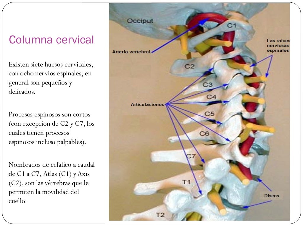 Espondilosis Cervical