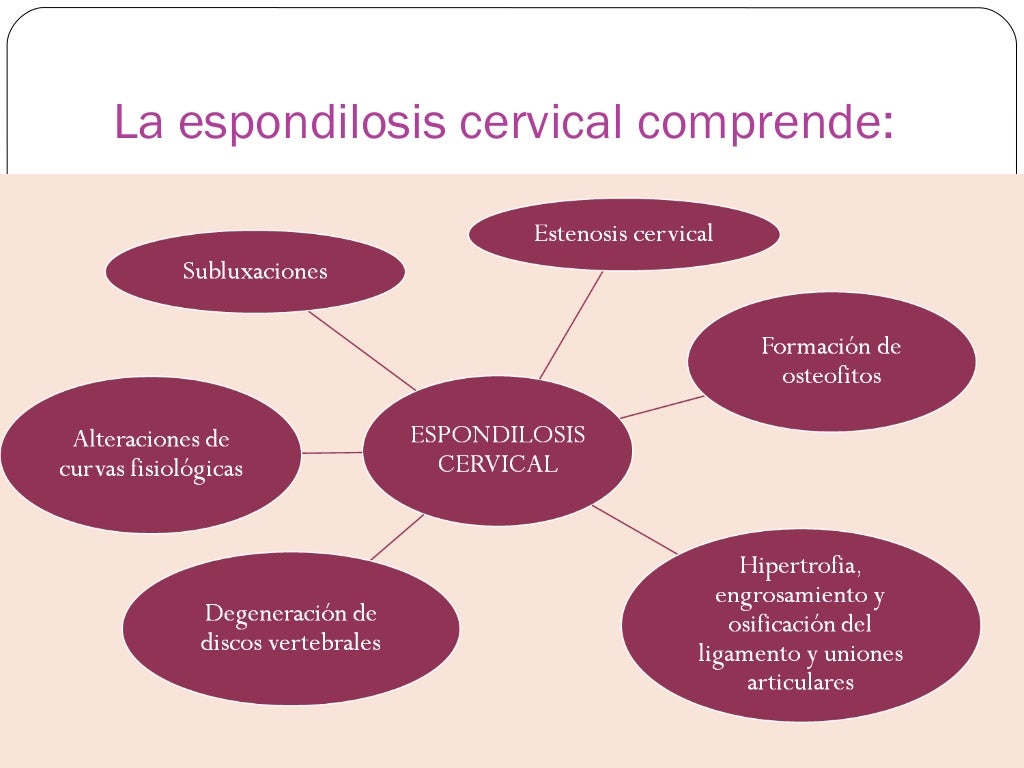 Espondilosis Cervical
