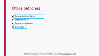 Otros patrones
■ Dermatitis de contacto
■ Eccema numular
■ Dermatitis seborreica
■ Dishidrosis
R.B Johnston, Weedon's Skin Pathology Essentials, 2011 pp; 121-153.
 