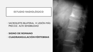 ESTUDIO RADIOLÓGICO
• SACROILEITIS BILATERAL → LESIÓN MÁS
PRECOZ. ALTA SENSIBILIDAD
• SIGNO DE ROMANO
• CUADRANGULACIÓNVÉRTEBRAS
 