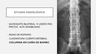 ESTUDIO RADIOLÓGICO
• SACROILEITIS BILATERAL → LESIÓN MÁS
PRECOZ. ALTA SENSIBILIDAD
• SIGNO DE ROMANO
CUADRATURA CUERPOVERTEBRAL
COLUMNA EN CAÑA DE BAMBÚ
 