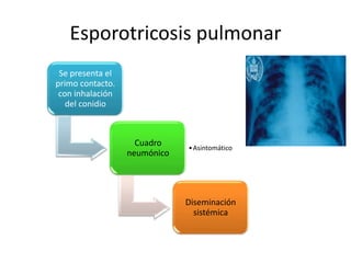 Esporotricosis pulmonar
 Se presenta el
primo contacto.
 con inhalación
   del conidio



                    Cuadro    • Asintomático
                  neumónico




                              Diseminación
                                sistémica
 
