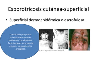 Esporotricosis cutánea-superficial
• Superficial dermoepidérmica o escrofulosa.


   Constituida por placas
   eritemato-escamosas,
  violáceas y pruriginosas.
 Casi siempres se presenta
   en cara y en pacientes
         anérgicos.
 
