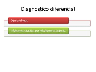 Diagnostico diferencial
Dermatofitosis


Infecciones causadas por micobacterias atípicas.
 