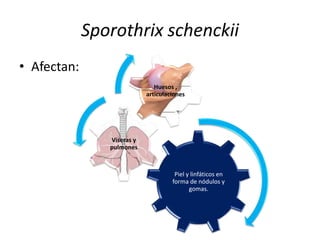 Sporothrix schenckii
• Afectan:
                               Huesos ,
                            articulaciones




                Viseras y
                pulmones



                                      Piel y linfáticos en
                                     forma de nódulos y
                                            gomas.
 