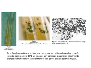 En la fase levaduriforme el hongo se reproduce en cultivos de cerebro corazón
infusión agar sangre a 37ºC las colonias son húmedas o cremosas inicialmente
blancas o amarillo claro, transformándose en pocos días en colonias negras.
 