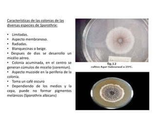 Características de las colonias de las
diversas especies de Sporothrix:

• Limitadas.
• Aspecto membranoso.
• Radiadas.
• Blanquecinas o beige.
• Despues de dias se desarrollo un
micélio aéreo.
• Colonia acuminada, en el centro se
generan cúmulos de micelio (coremiun).
• Aspecto mucoide en la periferia de la
colonia.
• Toma un café oscuro
• Dependiendo de los medios y la
cepa, puede no formar pigmentos
melánicos (Sporothrix albicans)
 
