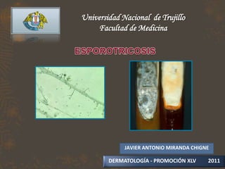 Universidad Nacional de Trujillo
    Facultad de Medicina




             JAVIER ANTONIO MIRANDA CHIGNE

        DERMATOLOGÍA - PROMOCIÓN XLV     2011
 