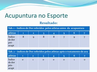 Acupuntura no Esporte
Resultado:
Tab. 1 – Indíces de Dor referidos pelos atletas antes da acupuntura
atletas 1 2 3 4 5 6 7
Índice
de dor
pré-
acupt
8 9 8 8 7 9 7
Tab. 2 – índices de Dor referidos pelos atletas após o tratamento de acu
atletas 1 2 3 4 5 6 7
Índice
de dor
pós-
acupt
0 1 0 0 0 1 0
 