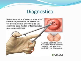 Diagnostico