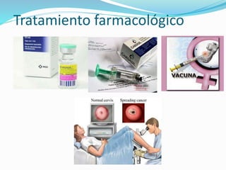 Tratamiento farmacológico