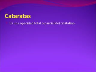 Cataratas
 Es una opacidad total o parcial del cristalino.
 