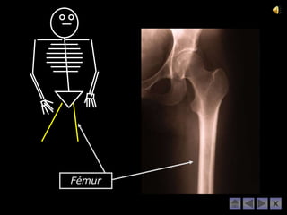 Fémur

        X
 