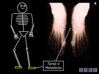 Tarso e
Metatarso
            X
 