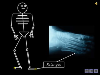Falanges
           X
 