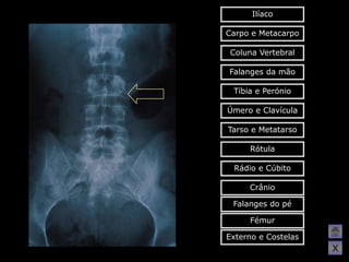 Ilíaco

Carpo e Metacarpo

 Coluna Vertebral

Falanges da mão

 Tíbia e Perónio

Úmero e Clavícula

Tarso e Metatarso

     Rótula

 Rádio e Cúbito

     Crânio

 Falanges do pé

     Fémur

Externo e Costelas
                     X
 