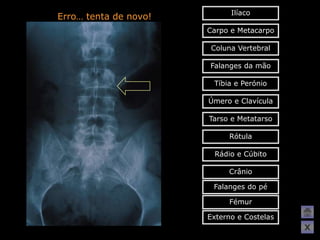 Ilíaco
Erro… tenta de novo!
                       Carpo e Metacarpo

                        Coluna Vertebral

                       Falanges da mão

                        Tíbia e Perónio

                       Úmero e Clavícula

                       Tarso e Metatarso

                            Rótula

                        Rádio e Cúbito

                            Crânio

                        Falanges do pé

                            Fémur

                       Externo e Costelas
                                            X
 