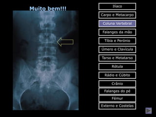 Ilíaco
Muito bem!!!
               Carpo e Metacarpo

                Coluna Vertebral

               Falanges da mão

                Tíbia e Perónio

               Úmero e Clavícula

               Tarso e Metatarso

                    Rótula

                Rádio e Cúbito

                    Crânio

                Falanges do pé

                    Fémur

               Externo e Costelas
 