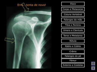 Ilíaco
Erro… tenta de novo!
                       Carpo e Metacarpo

                        Coluna Vertebral

                       Falanges da mão

                        Tíbia e Perónio

                       Úmero e Clavícula

                       Tarso e Metatarso

                            Rótula

                        Rádio e Cúbito

                            Crânio

                        Falanges do pé

                            Fémur

                       Externo e Costelas
                                            X
 