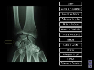 Ilíaco

Carpo e Metacarpo

 Coluna Vertebral

Falanges da mão

 Tíbia e Perónio

Úmero e Clavícula

Tarso e Metatarso

     Rótula

 Rádio e Cúbito

     Crânio

 Falanges do pé

     Fémur

Externo e Costelas
                     X
 