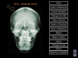 Ilíaco
Erro… tenta de novo!
                       Carpo e Metacarpo

                        Coluna Vertebral

                       Falanges da mão

                        Tíbia e Perónio

                       Úmero e Clavícula

                       Tarso e Metatarso

                            Rótula

                        Rádio e Cúbito

                            Crânio

                        Falanges do pé

                            Fémur

                       Externo e Costelas
                                            X
 