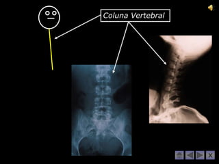 Coluna Vertebral




                   X
 