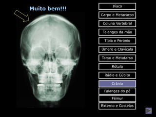 Ilíaco
Muito bem!!!
               Carpo e Metacarpo

                Coluna Vertebral

               Falanges da mão

                Tíbia e Perónio

               Úmero e Clavícula

               Tarso e Metatarso

                    Rótula

                Rádio e Cúbito

                    Crânio

                Falanges do pé

                    Fémur

               Externo e Costelas
 