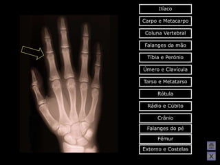 Ilíaco

Carpo e Metacarpo

 Coluna Vertebral

Falanges da mão

 Tíbia e Perónio

Úmero e Clavícula

Tarso e Metatarso

     Rótula

 Rádio e Cúbito

     Crânio

 Falanges do pé

     Fémur

Externo e Costelas
                     X
 