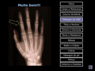 Ilíaco
Muito bem!!!
               Carpo e Metacarpo

                Coluna Vertebral

               Falanges da mão

                Tíbia e Perónio

               Úmero e Clavícula

               Tarso e Metatarso

                    Rótula

                Rádio e Cúbito

                    Crânio

                Falanges do pé

                    Fémur

               Externo e Costelas
 