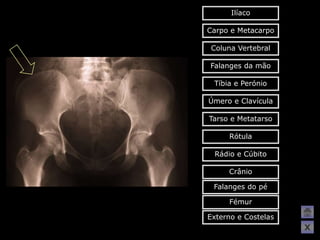 Ilíaco

Carpo e Metacarpo

 Coluna Vertebral

Falanges da mão

 Tíbia e Perónio

Úmero e Clavícula

Tarso e Metatarso

     Rótula

 Rádio e Cúbito

     Crânio

 Falanges do pé

     Fémur

Externo e Costelas
                     X
 