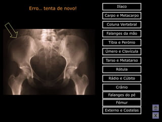 Ilíaco
Erro… tenta de novo!
                       Carpo e Metacarpo

                        Coluna Vertebral

                       Falanges da mão

                        Tíbia e Perónio

                       Úmero e Clavícula

                       Tarso e Metatarso

                            Rótula

                        Rádio e Cúbito

                            Crânio

                        Falanges do pé

                            Fémur

                       Externo e Costelas
                                            X
 