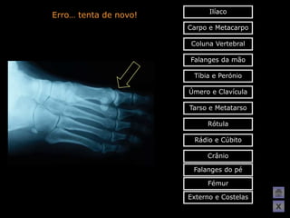 Ilíaco
Erro… tenta de novo!
                       Carpo e Metacarpo

                        Coluna Vertebral

                       Falanges da mão

                        Tíbia e Perónio

                       Úmero e Clavícula

                       Tarso e Metatarso

                            Rótula

                        Rádio e Cúbito

                            Crânio

                        Falanges do pé

                            Fémur

                       Externo e Costelas
                                            X
 
