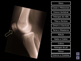 Ilíaco

Carpo e Metacarpo

 Coluna Vertebral

Falanges da mão

 Tíbia e Perónio

Úmero e Clavícula

Tarso e Metatarso

     Rótula

 Rádio e Cúbito

     Crânio

 Falanges do pé

     Fémur

Externo e Costelas
                     X
 