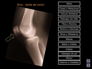 Ilíaco
Erro… tenta de novo!
                       Carpo e Metacarpo

                        Coluna Vertebral

                       Falanges da mão

                        Tíbia e Perónio

                       Úmero e Clavícula

                       Tarso e Metatarso

                            Rótula

                        Rádio e Cúbito

                            Crânio

                        Falanges do pé

                            Fémur

                       Externo e Costelas
                                            X
 