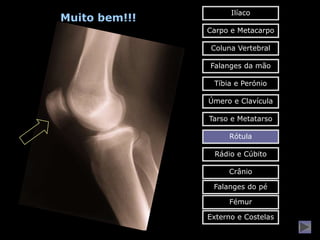Ilíaco
Muito bem!!!
               Carpo e Metacarpo

                Coluna Vertebral

               Falanges da mão

                Tíbia e Perónio

               Úmero e Clavícula

               Tarso e Metatarso

                    Rótula

                Rádio e Cúbito

                    Crânio

                Falanges do pé

                    Fémur

               Externo e Costelas
 