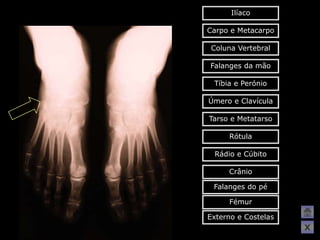 Ilíaco

Carpo e Metacarpo

 Coluna Vertebral

Falanges da mão

 Tíbia e Perónio

Úmero e Clavícula

Tarso e Metatarso

     Rótula

 Rádio e Cúbito

     Crânio

 Falanges do pé

     Fémur

Externo e Costelas
                     X
 