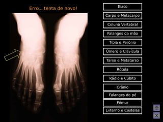 Ilíaco
Erro… tenta de novo!
                       Carpo e Metacarpo

                        Coluna Vertebral

                       Falanges da mão

                        Tíbia e Perónio

                       Úmero e Clavícula

                       Tarso e Metatarso

                            Rótula

                        Rádio e Cúbito

                            Crânio

                        Falanges do pé

                            Fémur

                       Externo e Costelas
                                            X
 