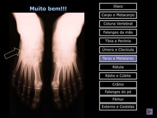 Ilíaco
Muito bem!!!
               Carpo e Metacarpo

                Coluna Vertebral

               Falanges da mão

                Tíbia e Perónio

               Úmero e Clavícula

               Tarso e Metatarso

                    Rótula

                Rádio e Cúbito

                    Crânio

                Falanges do pé

                    Fémur

               Externo e Costelas
 