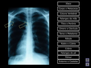 Ilíaco

Carpo e Metacarpo

 Coluna Vertebral

Falanges da mão

 Tíbia e Perónio

Úmero e Clavícula

Tarso e Metatarso

     Rótula

 Rádio e Cúbito

     Crânio

 Falanges do pé

     Fémur

Externo e Costelas
                     X
 